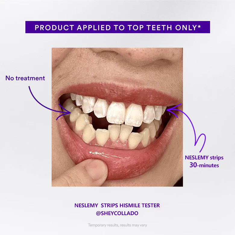Whitening Strips