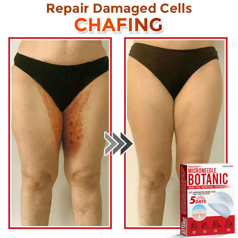 BotaniDot™ MicroNeedle Botanic Skin Tag Removal Patch 🇺🇸 Made in the USA