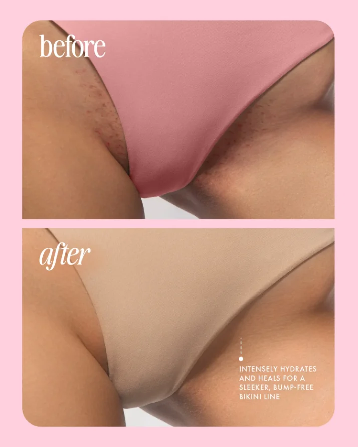 ⚡️ 5-Second Post-Hair Removal Rescue: Bumps Fade, Skin Glows! Glass Smooth Oil.⚡️Limited-Time Surprise Offer · Exclusive Perks for the First 300 Orders⚡️